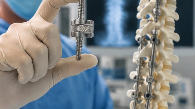 Life Spine's Latest Implant Receives FDA Approval: A Game Changer | baginda 168 slot link alternatif